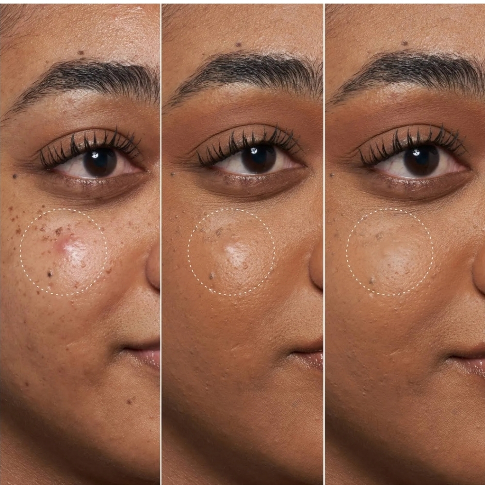 NIB Fenty Skin Blemish Defeat'r Spot Gel - Picture 5 of 7